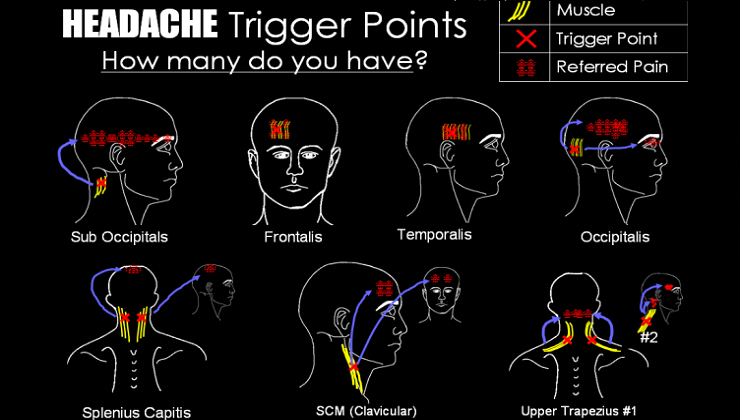 8 Headache Triggers you didn’t know were causing you Pain