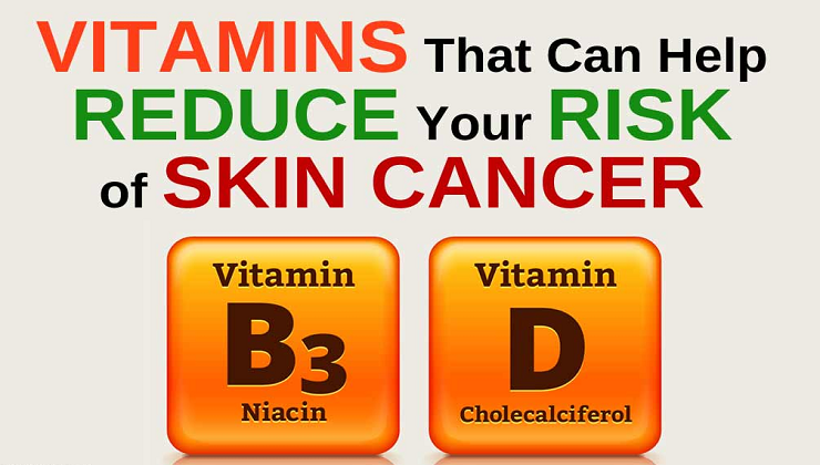 Can a Niacin Vitamin help lower your Skin Cancer Risk?