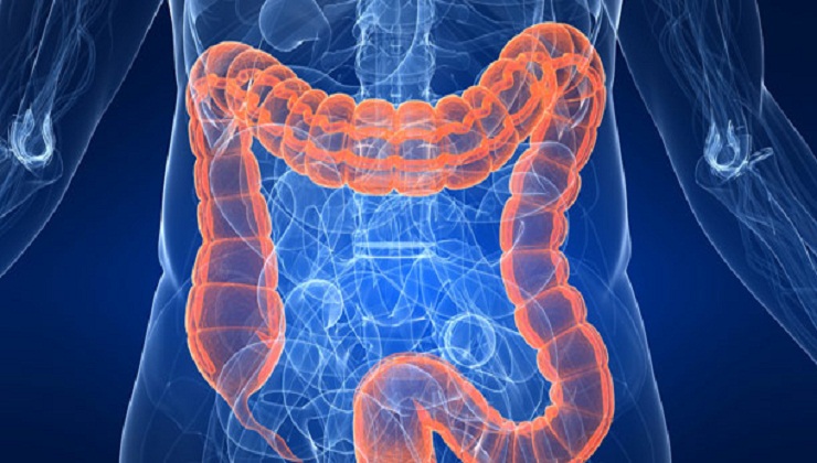 Study explores how High-fat Diet influences Colon Cancer