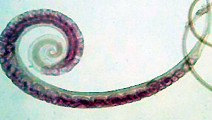 The most promising New Treatment for Inflammatory Bowel Disease? Parasitic worms