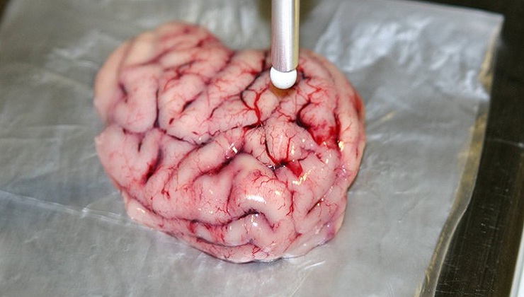 This new Smart Scalpel can automatically locate cancerous tumours in the Brain
