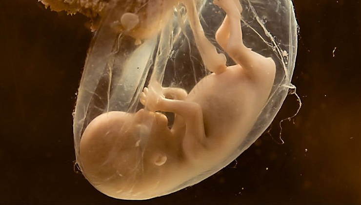 For the first time ever, Scientists have found a safe way to deliver Medicine to the Placenta