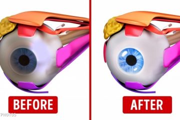10 Great Exercises to Improve Your Eyesight