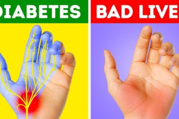 12 Health Problems your hands are warning you about