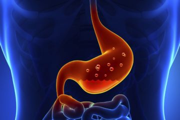 7 ways to treat Indigestion
