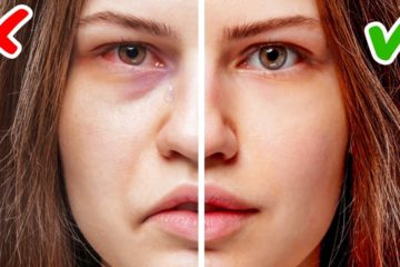 11 Signs of Health Problems hidden on your Face
