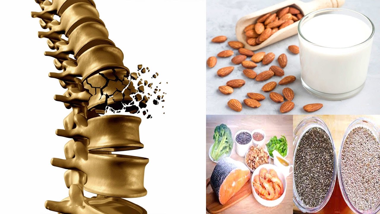 12 Foods that fight Osteoporosis and promote strong Bones Sports