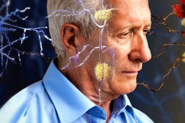 Alzheimer’s or Forgetfulness? How to tell the Difference