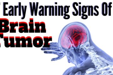 7 Early Warnings of A Brain Tumor to Never Ignore