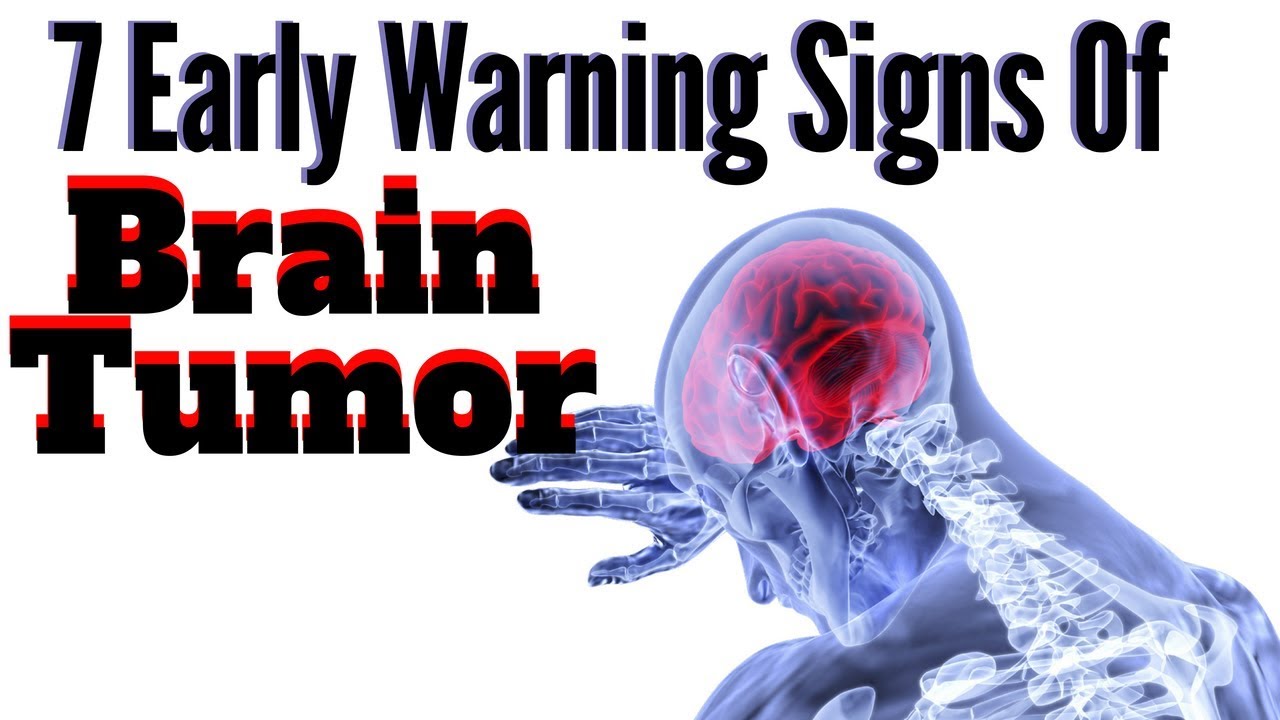 7 Early Warnings of A Brain Tumor to Never Ignore | Sports Health