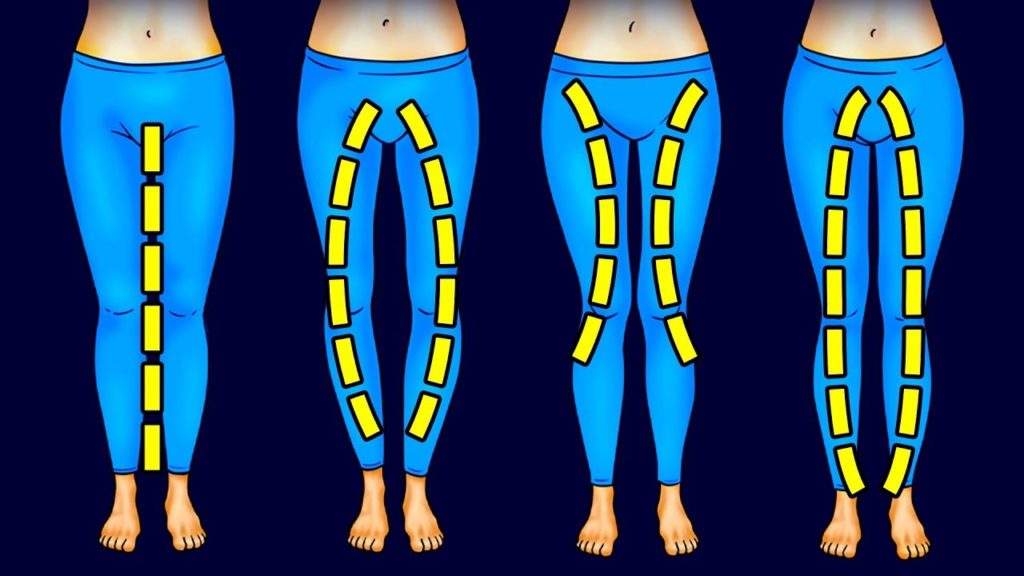 3 Exercises to Tone up your Legs according to your Leg shape