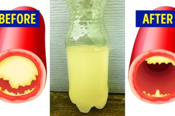 15 Foods that reduce your Heart Attack risk by 80%
