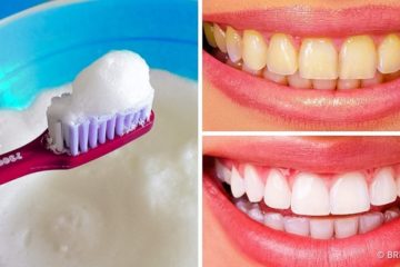 5 ways to Whiten your Teeth naturally