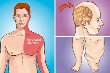 10 Surprising Heart Disease Warning Signs