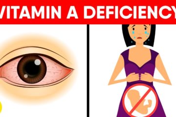 5 Signs of Vitamin A Deficiency you might be Ignoring