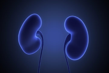 Symptoms & Prevention of Kidney Stones that can save your Life