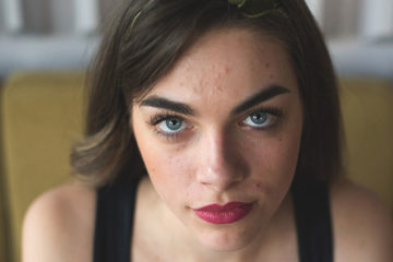 7 Easy ways to clear up your Acne