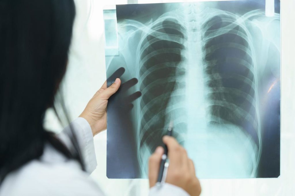 10 ways you can reverse Lung Damage