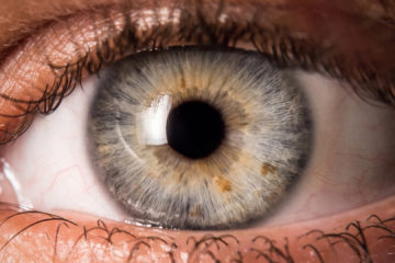 If you’re seeing Eye Floaters, Here’s what to do about them