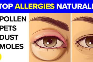 14 Natural ways to Defeat your Allergies