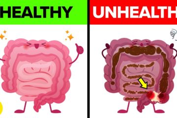 11 Ways to clean Gut Bacteria